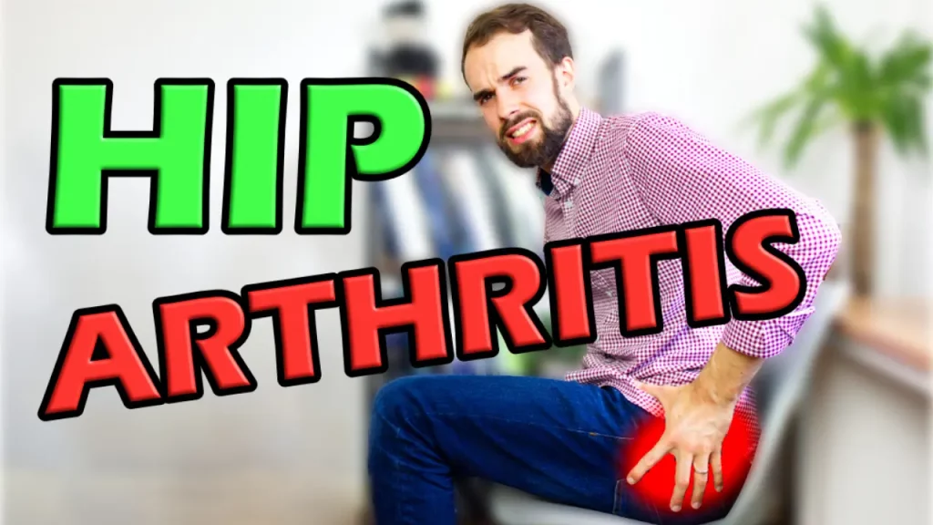 Hip Arthritis